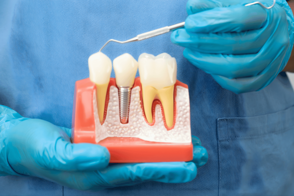 rize diş hekimi implant tedavisi