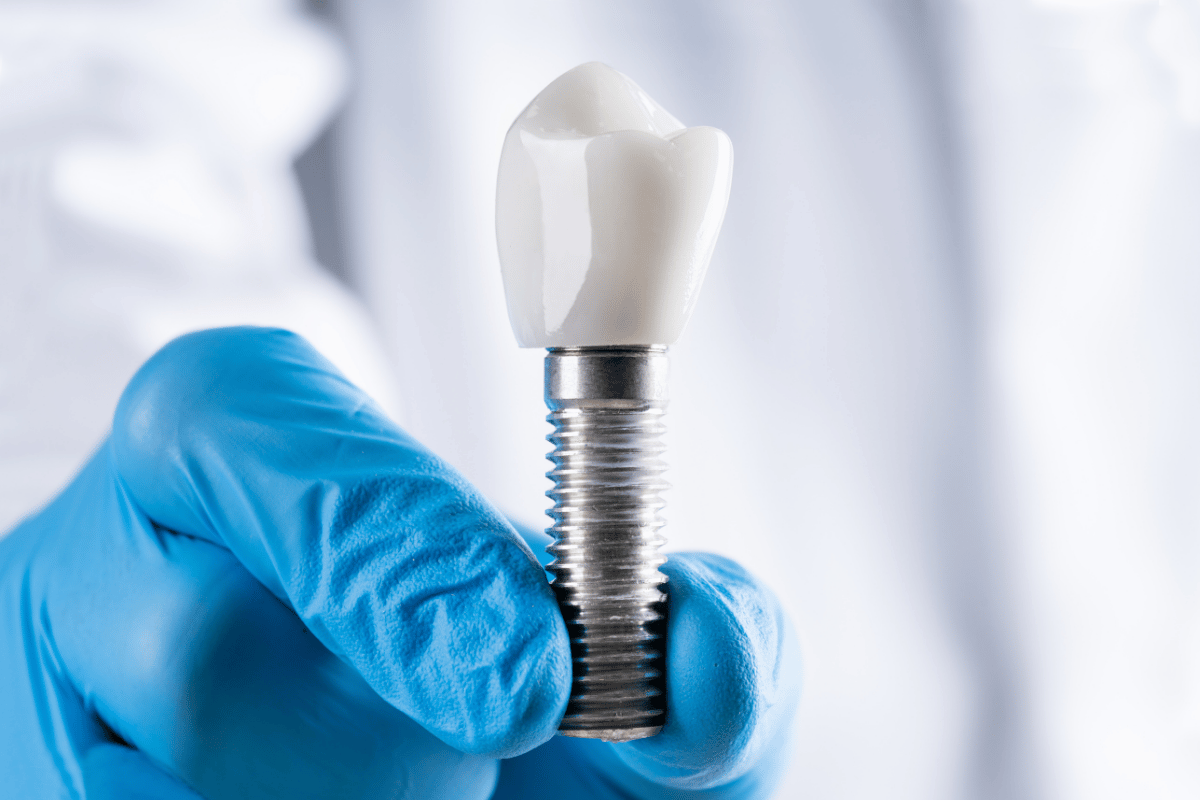 rize diş hekimi implant tedavisi